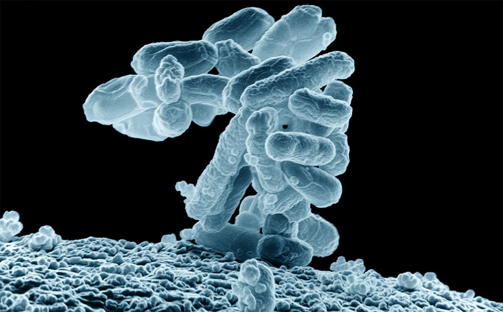 Cluster of E. coli bacteria, magnified at 10,000 times.