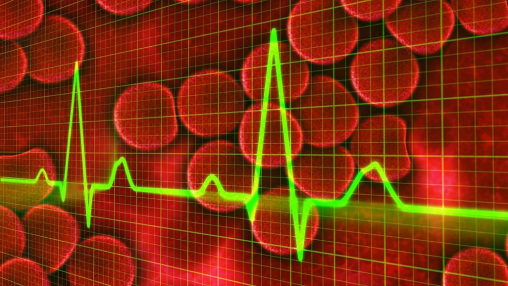 EKG lactate level